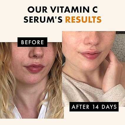 Best face serum