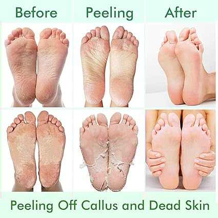 foot peel mask