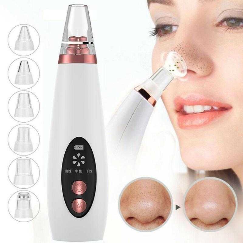 Blackhead remover vacuum